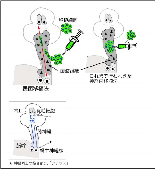 京都大学成功利用新细胞移植技术恢复听觉神经